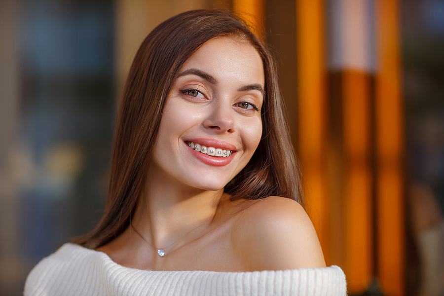 Smile Takeovers: Dental Crowns