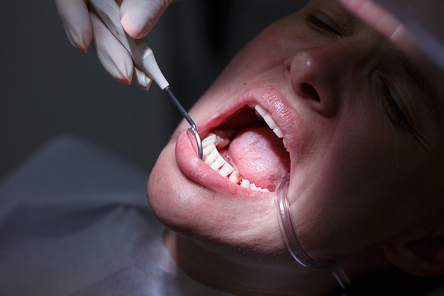 Achieve Optimal Gum Health with Expert Periodontics in Campbell, CA