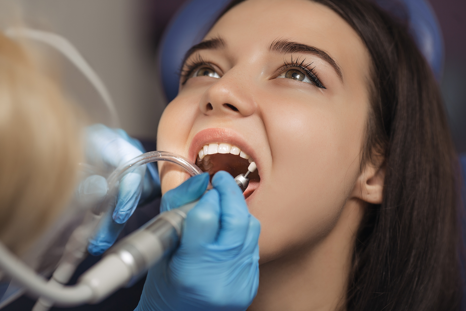 The Benefits of Root Canal Treatment: Why Saving Your Tooth is Worth It